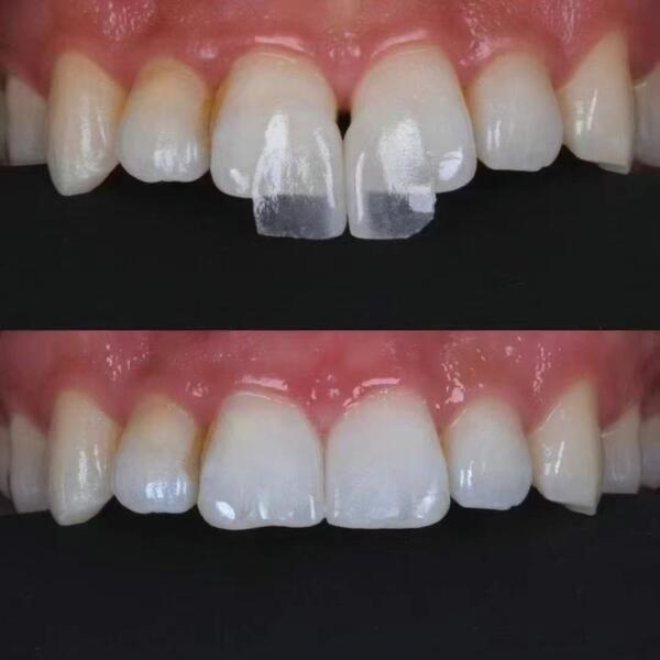 Shenzhen Berry Dental Equipment Co., Ltd