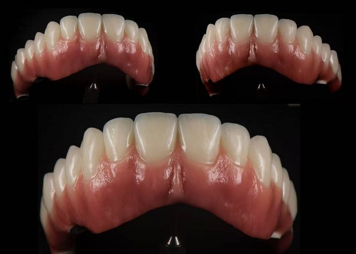 Quality Ceramic Dentures factory