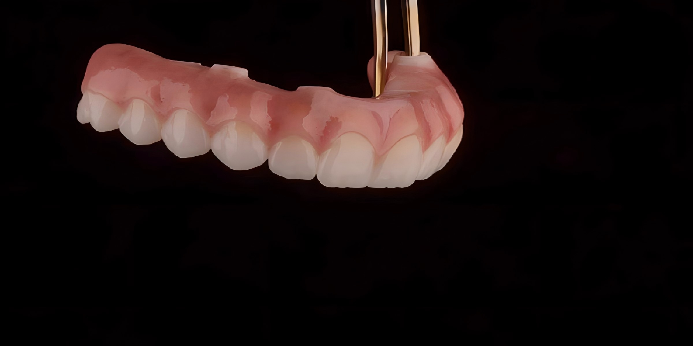 Quality Ceramic Dentures factory