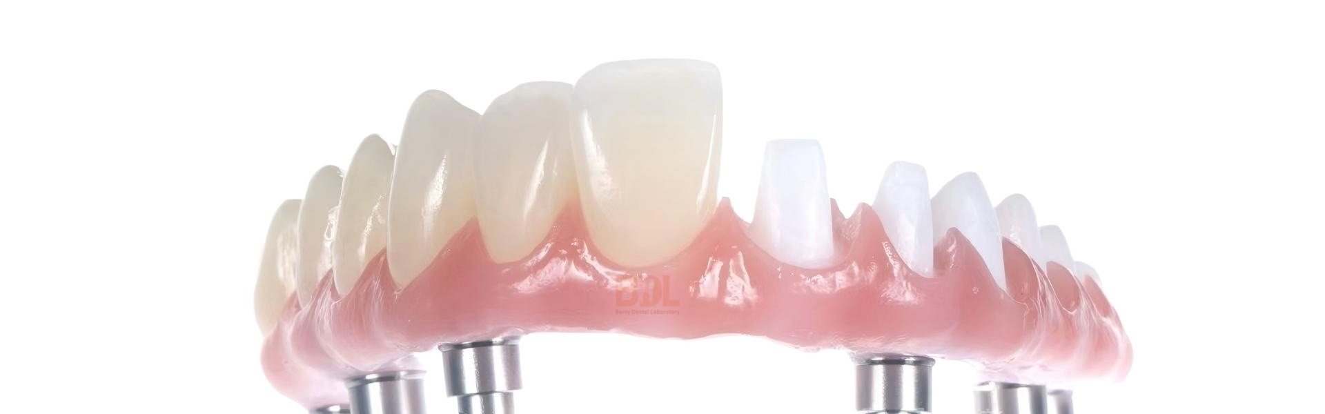 Qualità Dentiere in ceramica Fabbrica