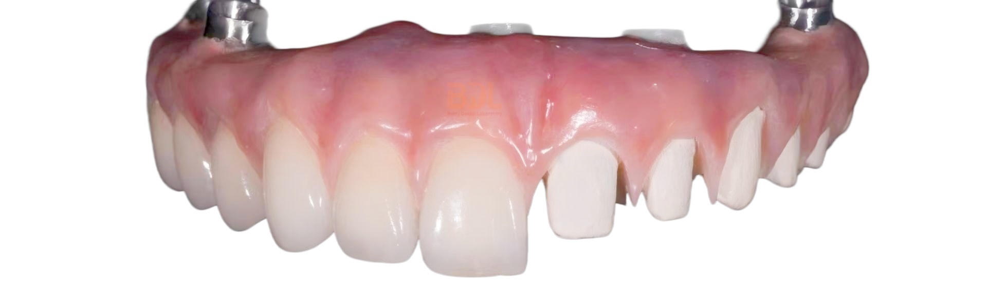 Chất lượng Răng giả bằng sứ Nhà máy