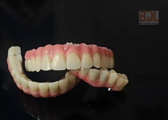 Maloney Zirconia Bridge Implant Bar For Dental Restoration Custom No Foreign Body Sensation