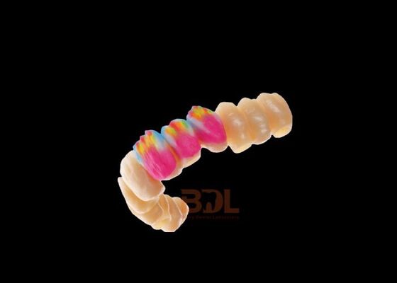 High Precision Zirconia All Ceramic Crown With Transparent And Moist Color