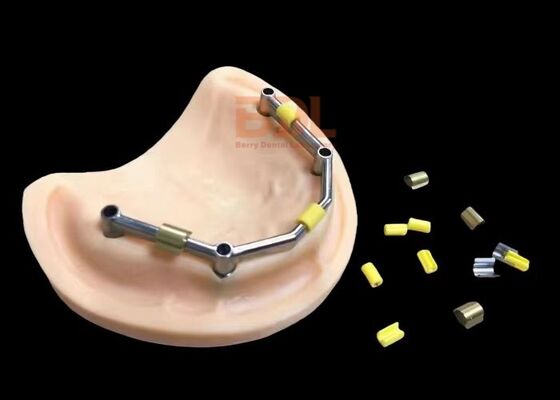9mm Implant Bar Malong Bridge Grade 5 Titanium Alloy Precision Engineered Dental Implant