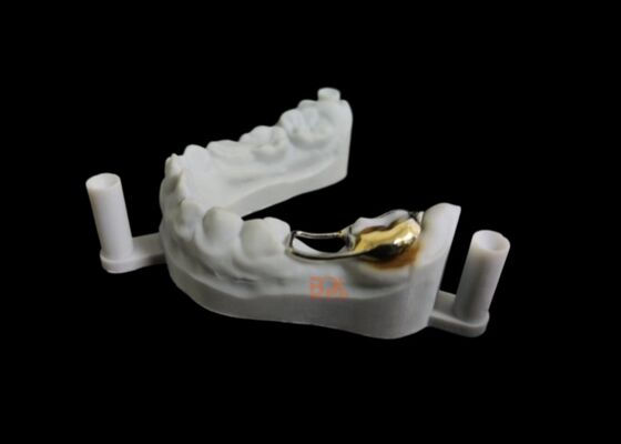 Safe Pediatric Dental Space Maintainers Manufactured to Maintain Tooth Alignment and Prevent Early Tooth Loss Complications