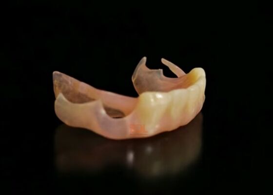 Flexible Partial Denture Prosthesis made from flexible nylon material offering superior comfort natural look and durability